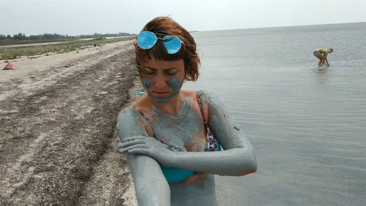 В Строганівці найчастіше лікуються від псоріазу